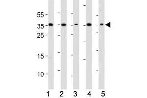 Western blot analysis of lysate from (1) A549, (2) HeLa, (3) HepG2, (4) Jurkat, (5) mouse NIH3T3 cell line using DKK1 antibody. (DKK1 抗体)