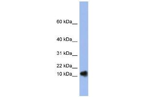 WB Suggested Anti-RNASE1 Antibody Titration:  0. (RNASE1 抗体  (N-Term))