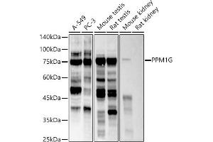 Western blot analysis of extracts of various cell lines, using PPM1G antibody (ABIN7269696) at 1:500 dilution. (PPM1G 抗体)