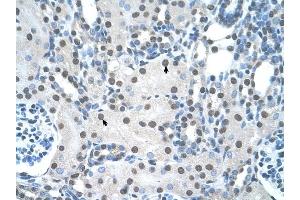 YWHAQ antibody was used for immunohistochemistry at a concentration of 4-8 ug/ml to stain Epithelial cells of renal tubule (arrows) in Human Kidney.
