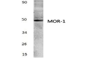 Image no. 1 for anti-Opioid Receptor, mu 1 (OPRM1) antibody (ABIN317766) (Mu Opioid Receptor 1 抗体)