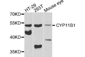 Western blot analysis of extracts of various cells, using CYP11B1 antibody. (CYP11B1 抗体)