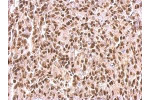 IHC-P Image MEF2C antibody detects MEF2C protein at nucleus on Saos2 xenograft by immunohistochemical analysis. (MEF2C 抗体)