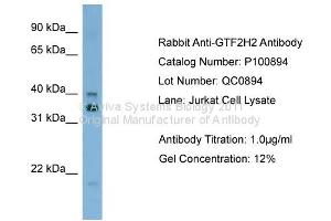 Western Blotting (WB) image for anti-General Transcription Factor IIH, Polypeptide 2, 44kDa (GTF2H2) (C-Term) antibody (ABIN2792641) (GTF2H2 抗体  (C-Term))