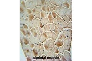 COX10 antibody (C-term) (ABIN654671 and ABIN2844366) immunohistochemistry analysis in formalin fixed and paraffin embedded human skeletal muscle followed by peroxidase conjugation of the secondary antibody and DAB staining. (COX10 抗体  (C-Term))