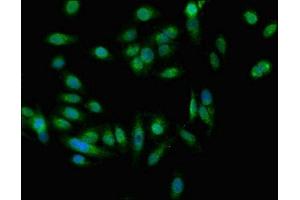 Immunofluorescent analysis of Hela cells using ABIN7151326 at dilution of 1:100 and Alexa Fluor 488-congugated AffiniPure Goat Anti-Rabbit IgG(H+L) (EEA1 抗体  (AA 734-875))
