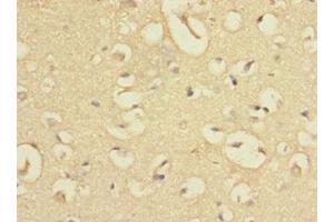 Immunohistochemistry of paraffin-embedded human brain tissue using ABIN7165334 at dilution of 1:100 (EVI2A 抗体  (AA 31-133))
