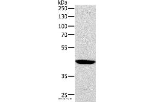 Western blot analysis of Human lymphoma tissue, using SOX7 Polyclonal Antibody at dilution of 1:1100 (SOX7 抗体)