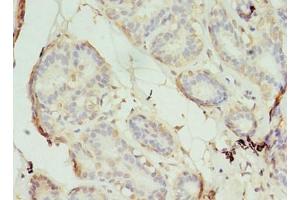 Immunohistochemistry of paraffin-embedded human breast cancer using ABIN7170565 at dilution of 1:100 (S1PR1 抗体  (AA 311-382))