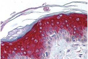 Human Skin (formalin-fixed, paraffin-embedded) stained with RPS6KA1 antibody ABIN213975 at 5 ug/ml followed by biotinylated goat anti-rabbit IgG secondary antibody ABIN481713, alkaline phosphatase-streptavidin and chromogen. (RPS6KA1 抗体  (N-Term))