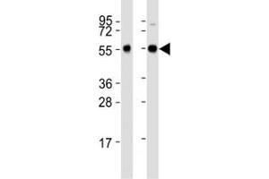 Western Blotting (WB) image for anti-Beclin 1, Autophagy Related (BECN1) (AA 388-421) antibody (ABIN3028502)