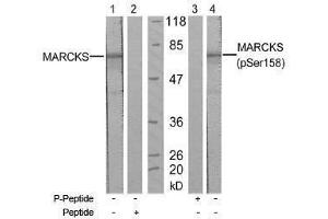 Image no. 1 for anti-Myristoylated Alanine-Rich Protein Kinase C Substrate (MARCKS) (pSer158) antibody (ABIN197065) (MARCKS 抗体  (pSer158))