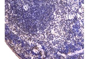 IHC analysis of EWSR1 using anti-EWSR1 antibody (ABIN6719313).