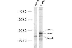 dilution: 1 : 1000, sample: crude synaptosomal fraction of rat brain (P2) (VAMP1, 2, 3 (AA 1-81) 抗体)