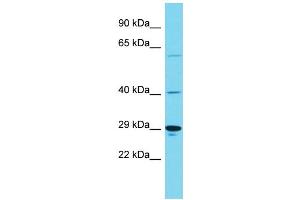 Host: Rabbit Target Name: KIAA1919 Sample Type: Hela Whole Cell lysates Antibody Dilution: 1. (KIAA1919 抗体  (Middle Region))