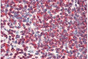 Human Spleen: Formalin-Fixed, Paraffin-Embedded (FFPE) (WDHD1 抗体  (C-Term))