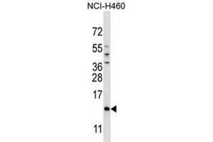 SMCP Antibody (C-term) western blot analysis in NCI-H460 cell line lysates (35µg/lane). (SMCP 抗体  (C-Term))