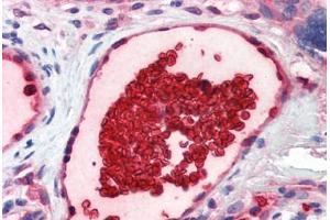 Human Placenta, Vessel with Erythrocytes (formalin-fixed, paraffin-embedded) stained with GYPA antibody ABIN337240 at 5 ug/ml followed by biotinylated goat anti-rabbit IgG secondary antibody ABIN481713, alkaline phosphatase-streptavidin and chromogen. (CD235a/GYPA 抗体  (N-Term))