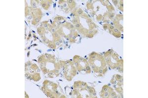 Immunohistochemistry of paraffin-embedded human stomach using SYT4 antibody (ABIN5975174) at dilution of 1/100 (40x lens). (SYT4 抗体)