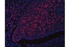 IF analysis of RFX1 using anti-RFX1 antibody (ABIN7601842).
