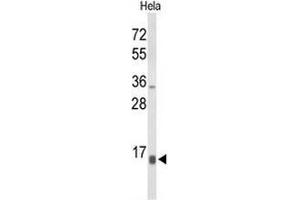 Western blot analysis of NPW Antibody (C-term) in Hela cell line lysates (35µg/lane). (NPW 抗体  (C-Term))
