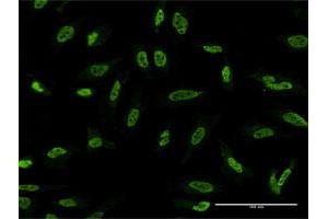 Immunofluorescence (IF) image for anti-serine/threonine Kinase 24 (STK24) (AA 1-431) antibody (ABIN521891)