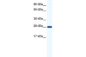 WB Suggested Anti-DLX4 Antibody Titration:  1. (DLX4 抗体  (N-Term))