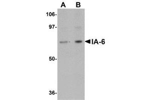 Western blot analysis of IA-6 in rat thymus tissue lysate with AP30397PU-N IA-6 antibody at (A) 1 and (B) 2 μg/ml. (INSM2 抗体  (C-Term))