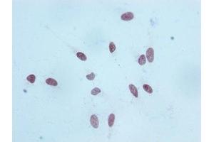 Immunocytochemistry analysis of ABIN7127300 diluted at 1:100 and staining in Hela cells performed on a Leica BondTM system. (Recombinant HIST1H3A 抗体  (H3K18me))