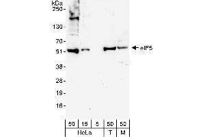Western Blotting (WB) image for anti-Eukaryotic Translation Initiation Factor 5 (EIF5) (AA 100-150) antibody (ABIN7453077)