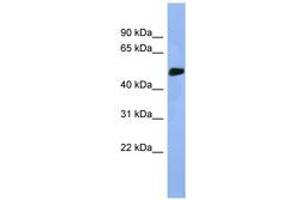 Image no. 1 for anti-serine/threonine Kinase 25 (STK25) (AA 274-323) antibody (ABIN6746292) (STK25 抗体  (AA 274-323))