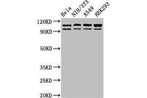 Western Blot Positive WB detected in: Hela whole cell lysate, NIH/3T3 whole cell lysate, A549 whole cell lysate, HEK293 whole cell lysate All lanes: MSH2 antibody at 2 μg/mL Secondary Goat polyclonal to rabbit IgG at 1/50000 dilution Predicted band size: 105, 98 kDa Observed band size: 105, 98 kDa (MSH2 抗体  (AA 2-254))