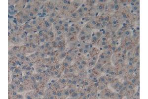 DAB staining on IHC-P; Samples: Human Liver Tissue (DDR1 抗体  (AA 568-829))