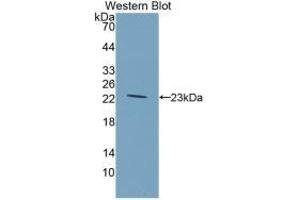 Detection of Recombinant GKRP, Rat using Monoclonal Antibody to Glucokinase Regulatory Protein (GKRP) (GCKR 抗体  (AA 90-286))