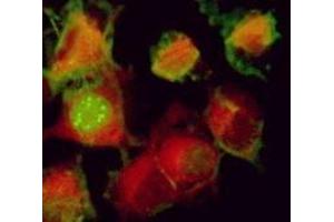 Immunofluorescence (IF) image for anti-Herpes Simplex Virus Type 1 ICP0 (HSV1 ICP0) antibody (ABIN265560) (HSV1 ICP0 抗体)