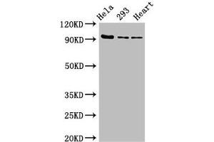 Western Blot Positive WB detected in: Hela whole cell lysate, 293 whole cell lysate, Rat heart tissue All lanes: MCM4 antibody at 2. (MCM4 抗体  (AA 2-141))
