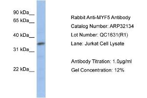 Western Blotting (WB) image for anti-Myogenic Factor 5 (MYF5) (N-Term) antibody (ABIN182493) (MYF5 抗体  (N-Term))