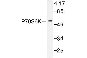 Image no. 1 for anti-Ribosomal Protein S6 Kinase, 70kDa, Polypeptide 1 (RPS6KB1) antibody (ABIN272051) (RPS6KB1 抗体)