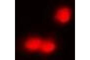 Immunofluorescent analysis of IRF8 staining in A549 cells. (IRF8 抗体)