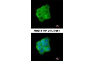 ICC/IF Image Immunofluorescence analysis of paraformaldehyde-fixed A431, using Cytokeratin 13, antibody at 1:200 dilution. (Cytokeratin 13 抗体)