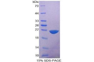 SDS-PAGE (SDS) image for Interleukin 1 delta (FIL1d) (AA 1-156) protein (His tag) (ABIN2125428)