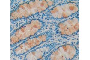 Used in DAB staining on fromalin fixed paraffin- embedded Kidney tissue (IRS2 抗体  (AA 985-1255))