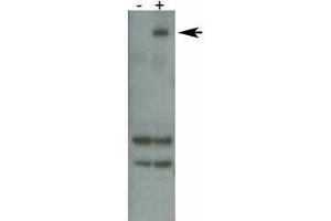 PARK8 / LRRK2 antibody detects over-expressed human LRRK2 protein. (LRRK2 抗体  (AA 878-909))