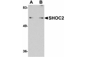 Image no. 1 for anti-Leucine-rich repeat protein SHOC-2 (SHOC2) (N-Term) antibody (ABIN478033) (SHoc2/Sur8 抗体  (N-Term))