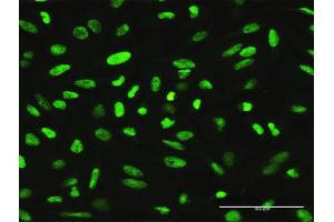 Immunofluorescence of purified MaxPab antibody to XRCC1 on HeLa cell. (XRCC1 抗体  (AA 1-633))