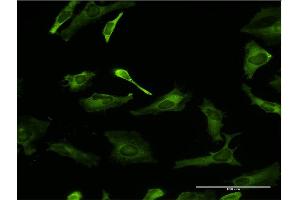 Immunofluorescence (IF) image for anti-Poly(rC) Binding Protein 2 (PCBP2) (AA 1-362) antibody (ABIN518656)