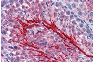 Mouse Testis (formalin-fixed, paraffin-embedded) stained with BSG antibody ABIN462349 followed by biotinylated secondary antibody, alkaline phosphatase-streptavidin and chromogen. (CD147 抗体)