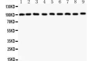 Anti-CBL Picoband antibody, All lanes: Anti-CBL at 0. (CBL 抗体  (AA 556-906))