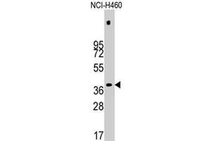 Western blot analysis of PDHX polyclonal antibody  in NCI-H460 cell line lysates (35 ug/lane). (PDHX 抗体  (Thr11))