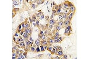 Immunohistochemistry (IHC) image for anti-Matrix Metallopeptidase 9 (Gelatinase B, 92kDa Gelatinase, 92kDa Type IV Collagenase) (MMP9) (AA 644-673) antibody (ABIN3031728)